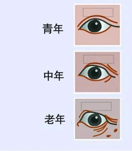 衰老到底是怎么回事呢,人老珠黄,人老珠黄是哪里黄 衰老到底是怎么回事呢,人老珠黄,人老珠黄是哪里黄